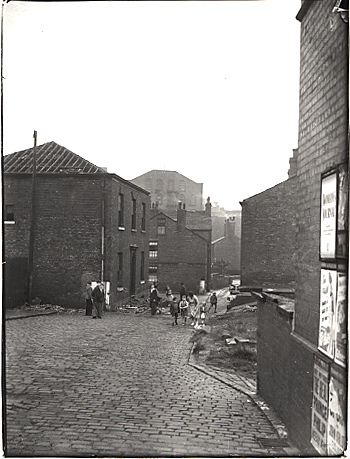 Mumps, Oldham